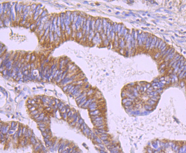 Anti-ERP29 Antibody (2E160)
