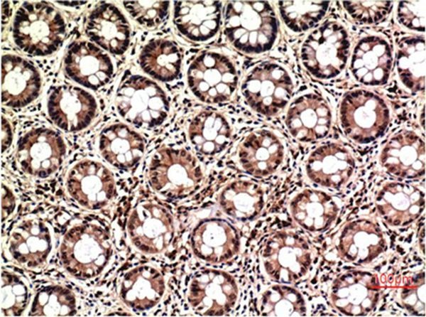 Anti-MAPK3/1 Antibody (7H964)