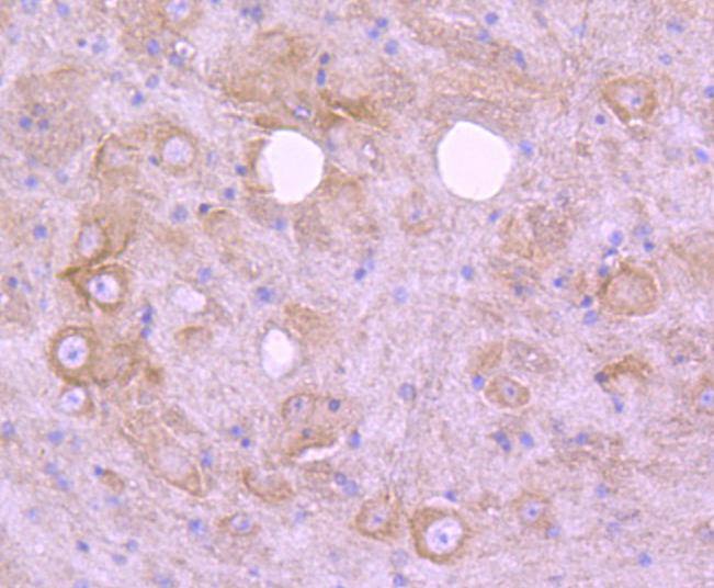 Anti-EGFR Antibody (2W575)
