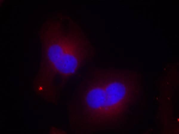 Anti-Phospho-PTK2 (Tyr925) Polyclonal Antibody