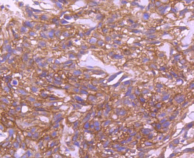 Anti-EGFR Antibody (2W575)