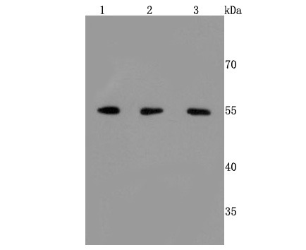 Anti-PDIA3 Antibody (8V206)