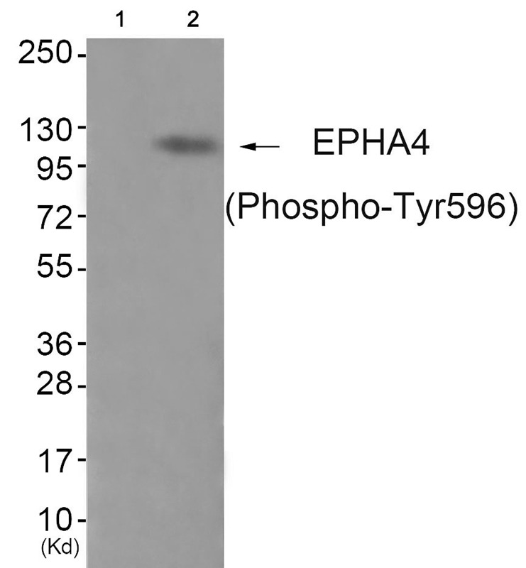 Anti-Phospho-EphA4 (Tyr596) Polyclonal Antibody