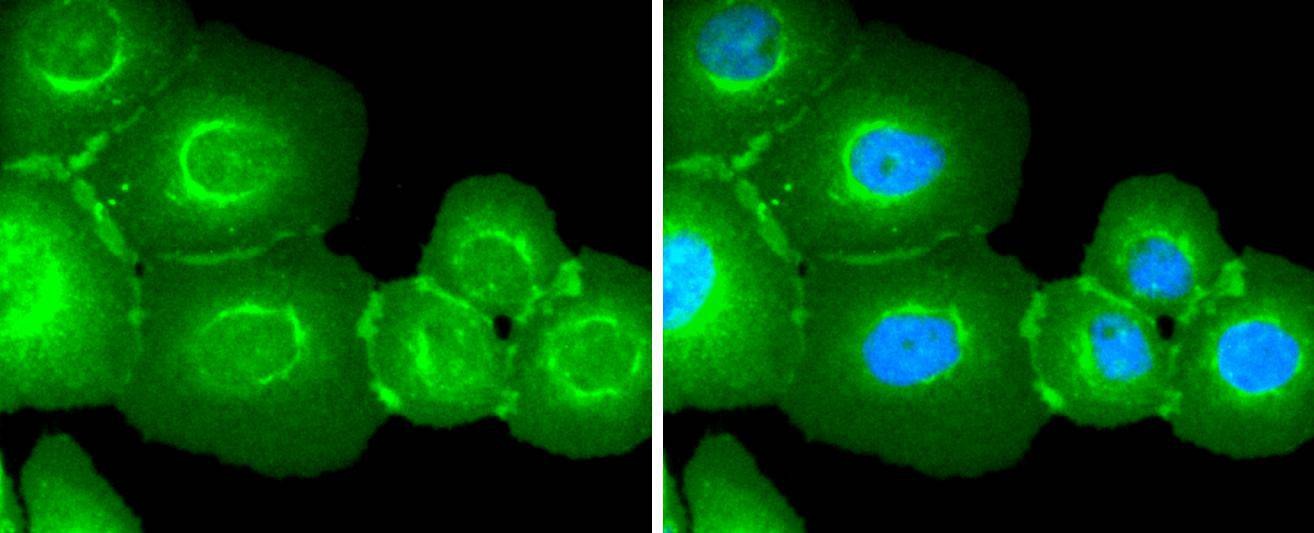 Anti-EGFR Antibody (2W575)