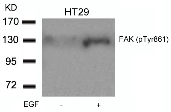 Anti-Phospho-PTK2 (Tyr861) Polyclonal Antibody
