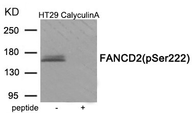 Anti-Phospho-FANCD2 (Ser222) Polyclonal Antibody