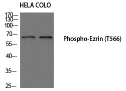 Anti-Phospho-Ezrin (Thr566) Polyclonal Antibody