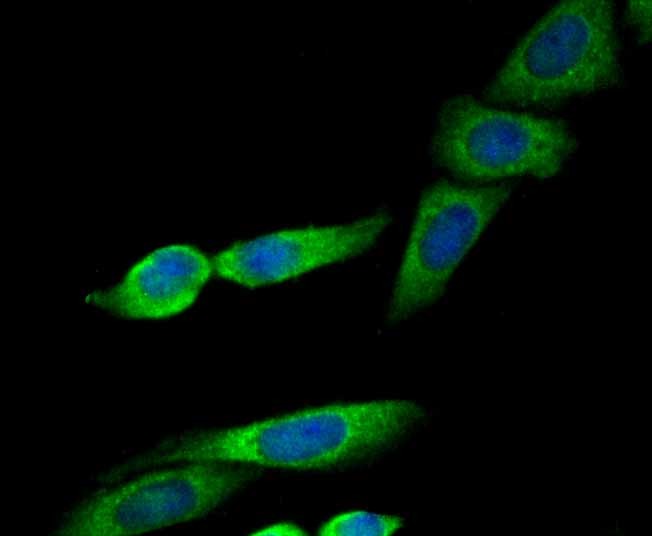 Anti-ERP29 Antibody (2E160)