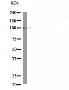 Anti-Phospho-EZH2 (Thr487) Polyclonal Antibody 2