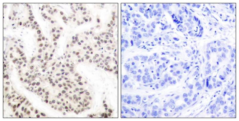 Anti-Phospho-ELK1 (Thr417) Polyclonal Antibody