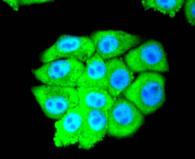 Anti-EIF5A Antibody (9P939)