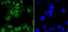 Anti-FANCD2 Antibody (8B144)