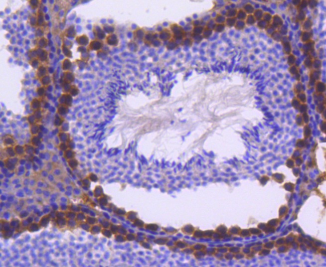 Anti-FANCD2 Antibody (8B144)