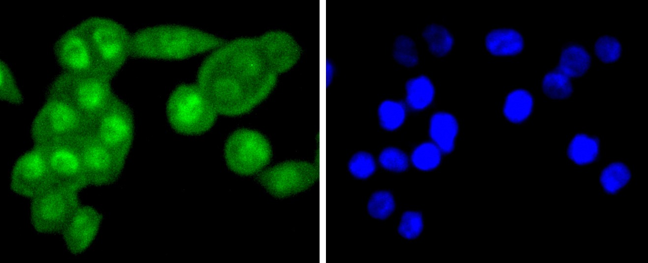 Anti-FANCD2 Antibody (8B144)