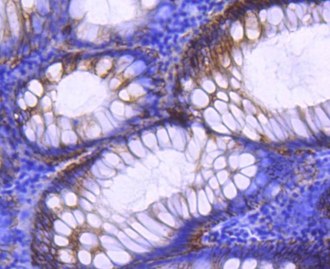 Anti-EpCAM/TROP1 Antibody (1I547)