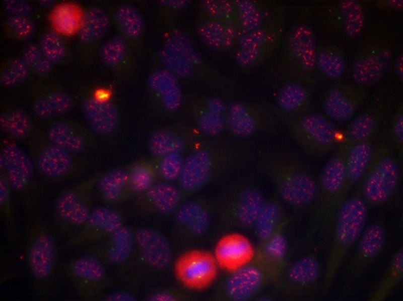 Anti-Phospho-ELK1 (Thr417) Polyclonal Antibody