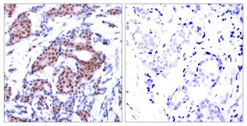 Anti-Phospho-ELK1 (Ser383) Polyclonal Antibody