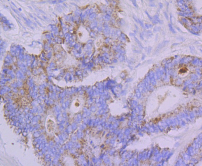 Anti-Emi1 Antibody (9H429)