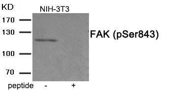 Anti-Phospho-PTK2 (Ser843) Polyclonal Antibody