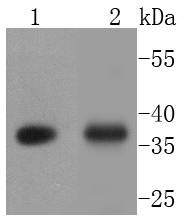 Anti-EpCAM/TROP1 Antibody (1I547)