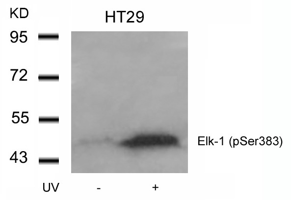 Anti-Phospho-ELK1 (Ser383) Polyclonal Antibody
