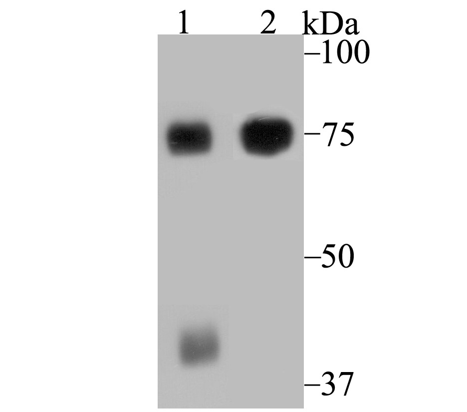 Anti-ELMO1 Antibody (8W516)