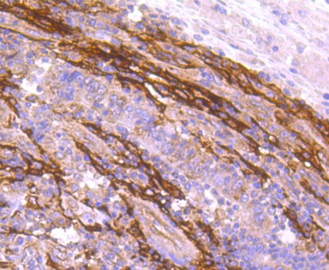 Anti-FAP1 Antibody (6P590)