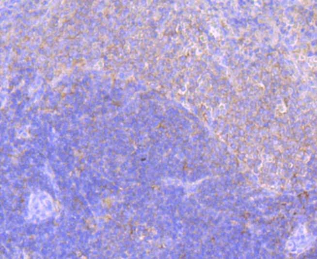 Anti-ELMO1 Antibody (8W516)