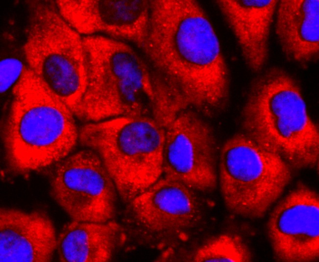 Anti-S1PR1 Antibody (9T480)