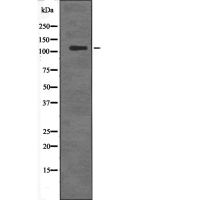 Anti-Phospho-DDEF2 (Ser701) Polyclonal Antibody