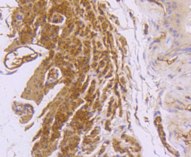 Anti-Desmin Antibody (2D838)