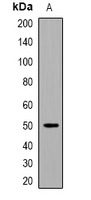 Anti-Acetyl-EEF1A1 (Lys146) Polyclonal Antibody