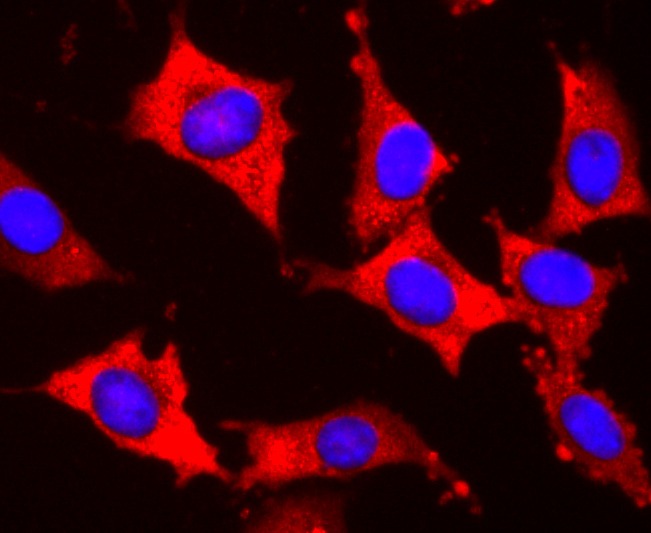 Anti-S1PR1 Antibody (9T480)