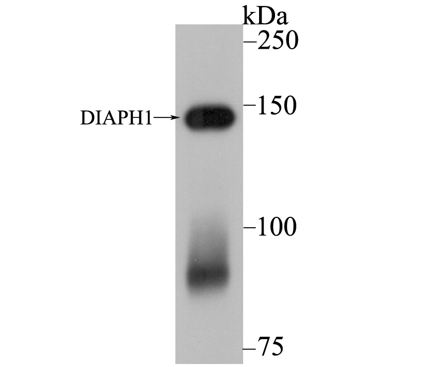 Anti-DIAPH1 Antibody (6T639)