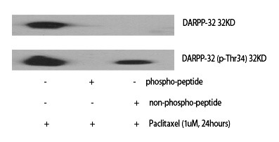 Anti-Phospho-DARPP-32 (Thr34) Polyclonal Antibody