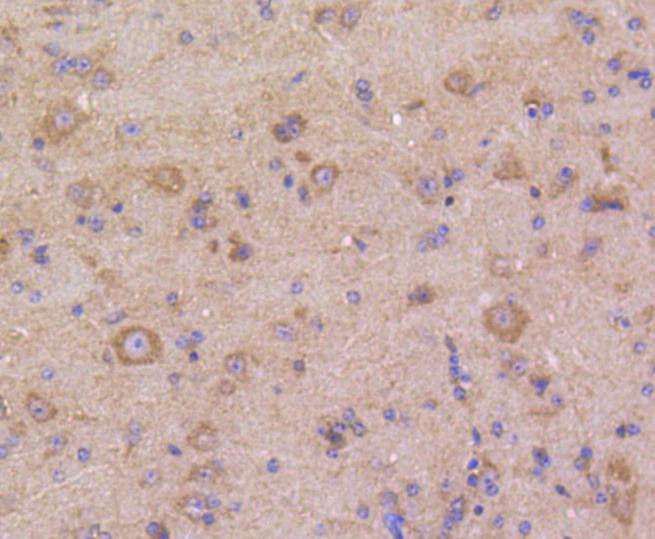 Anti-DUSP6 Antibody (2Q808)