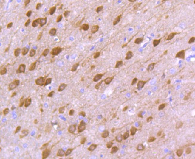 Anti-DARPP-32 Antibody (1B13)