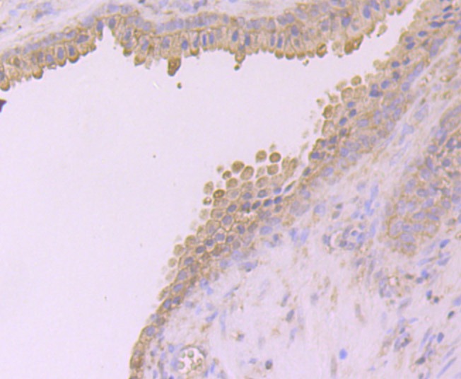 Anti-DSG-2/Desmoglein-2 Antibody (5U33)