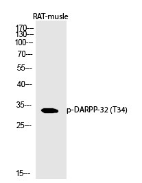 Anti-Phospho-DARPP-32 (Thr34) Polyclonal Antibody