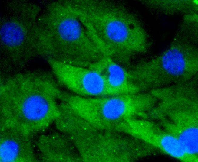 Anti-DUSP6 Antibody (2Q808)