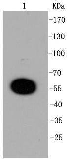 Anti-DUSP6 Antibody (2Q808)