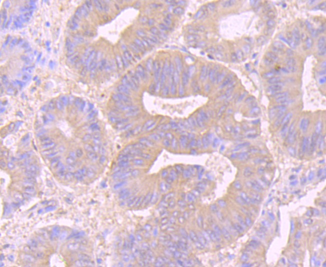 Anti-DSG-2/Desmoglein-2 Antibody (5U33)