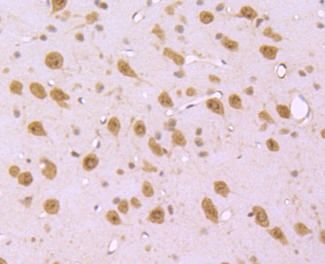 Anti-S1PR1 Antibody (9T480)
