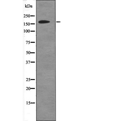 Anti-Phospho-DAPK1 (Ser736) Polyclonal Antibody