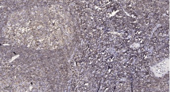 Anti-Phospho-DAPK1 (Ser308) Polyclonal Antibody 2