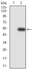 Anti-DHX58 Antibody (1Q521)