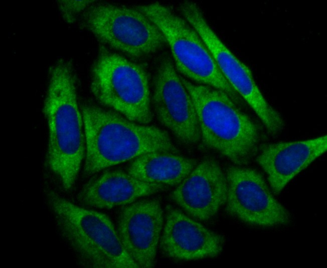 Anti-DCPLA Antibody (2R679)