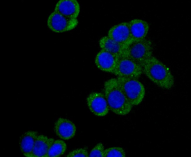 Anti-DIAPH1 Antibody (6T639)