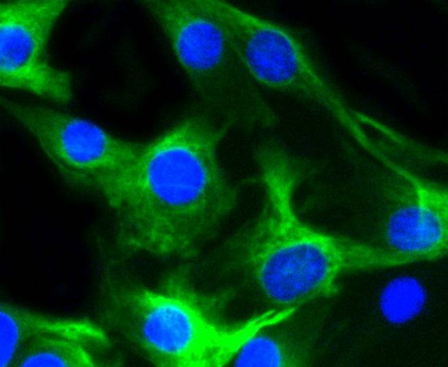 Anti-Desmin Antibody (2D838)