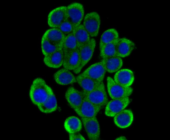 Anti-DCPLA Antibody (2R679)